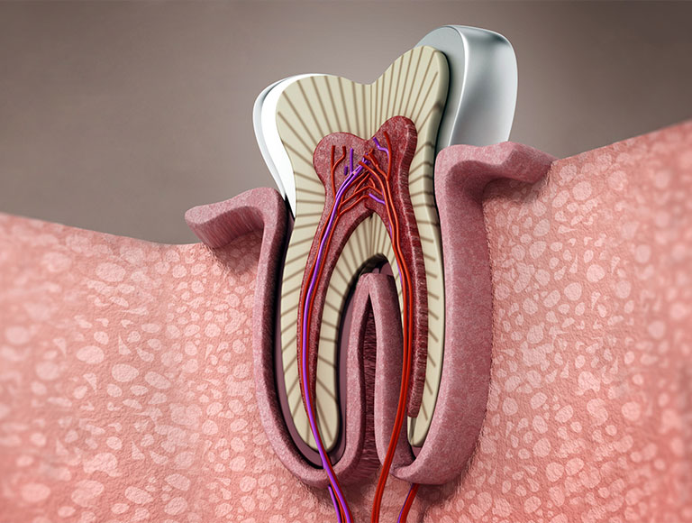 Benefits of Root Canal Therapy