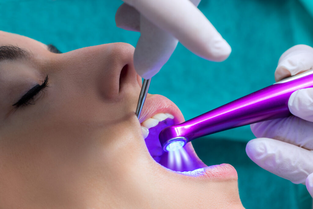 Featured image for Types of Dental Sealants