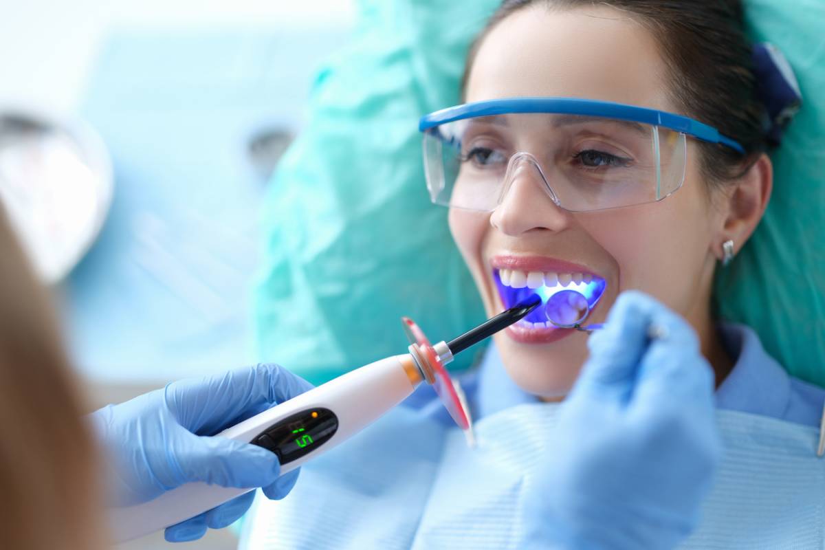 Featured image for How Do You Know If You Need Dental Bonding?